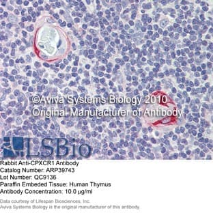 anti-CPX Chromosome Region, Candidate 1 (CPXCR1) (Middle Region) antibody avatar