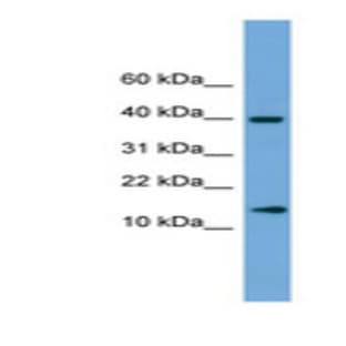 anti-ATPase, H+ Transporting, Lysosomal 13kDa, V1 Subunit G2 (ATP6V1G2) (Internal Region) antibody avatar