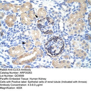anti-Chloride Intracellular Channel 5 (CLIC5) (C-Term) antibody avatar