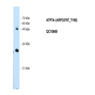 anti-ATPase, Cu++ Transporting, alpha Polypeptide (ATP7A) (N-Term) antibody avatar