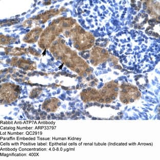 anti-ATPase, Cu++ Transporting, alpha Polypeptide (ATP7A) (N-Term) antibody avatar