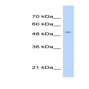 anti-Chromosome 11 Open Reading Frame 24 (C11orf24) (N-Term) antibody avatar