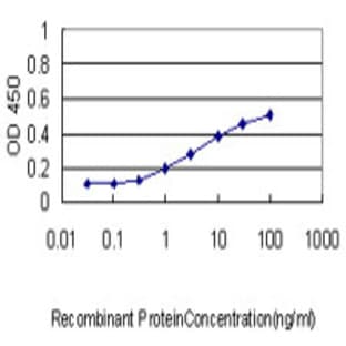 anti-ATPase, Cu++ Transporting, beta Polypeptide (ATP7B) (AA 1372-1466) antibody avatar
