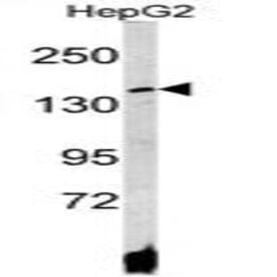 anti-ATPase, Cu++ Transporting, beta Polypeptide (ATP7B) (C-Term) antibody avatar