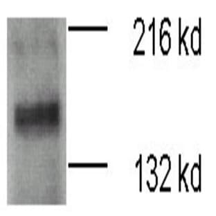 anti-ATPase, Cu++ Transporting, beta Polypeptide (ATP7B) (N-Term) antibody avatar