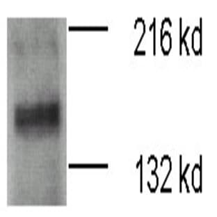 anti-ATPase, Cu++ Transporting, beta Polypeptide (ATP7B) (N-Term) antibody avatar
