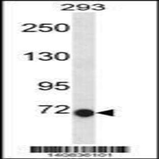 anti-Chloride Intracellular Channel 6 (CLIC6) (C-Term), (AA 676-704) antibody avatar