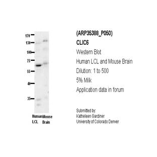 anti-Chloride Intracellular Channel 6 (CLIC6) (Middle Region) antibody avatar