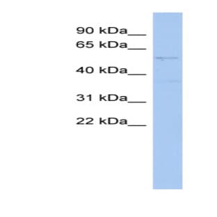 anti-SET and MYND Domain Containing 2 (SMYD2) (Middle Region) antibody avatar