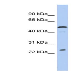 anti-Chromosome 1 Open Reading Frame 190 (C1orf190) (Middle Region) antibody avatar