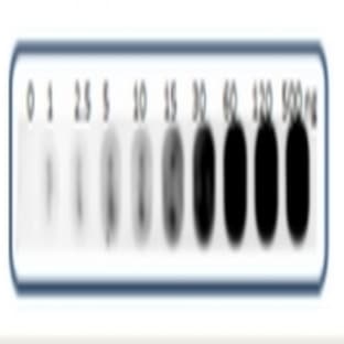 anti-Adrenocorticotropic hormone (ACTH) (AA 1-39), (N-Term) antibody avatar