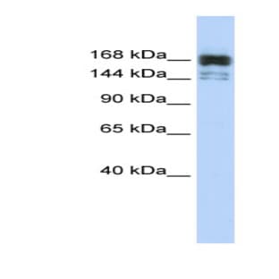 anti-5'-3' Exoribonuclease 1 (XRN1) (Middle Region) antibody avatar