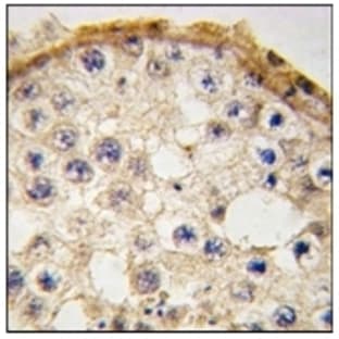 anti-DEAD Box Protein 4 (DDX4) (C-Term) antibody avatar