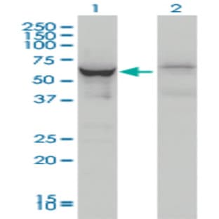 anti-DEAD (Asp-Glu-Ala-Asp) Box Polypeptide 56 (DDX56) (AA 450-548) antibody avatar