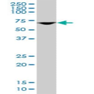 anti-DEAD (Asp-Glu-Ala-Asp) Box Polypeptide 56 (DDX56) (AA 450-548) antibody avatar