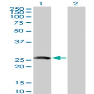 anti-B-Cell Translocation Gene 4 (BTG4) (AA 1-207) antibody avatar
