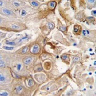 anti-Cytochrome P450, Family 2, Subfamily W, Polypeptide 1 (CYP2W1) (N-Term) antibody avatar
