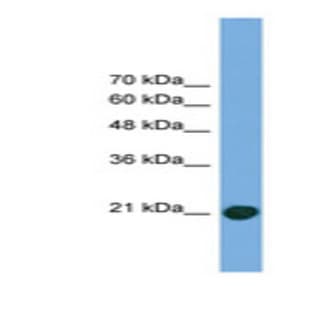 anti-COMM Domain Containing 8 (COMMD8) (Internal Region) antibody avatar