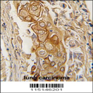 anti-Acid Phosphatase, Prostate (ACPP) (C-Term), (AA 313-341) antibody avatar