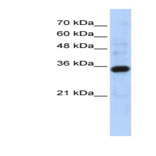 anti-Complement C1q Tumor Necrosis Factor-Related Protein 4 (C1QTNF4) (Middle Region) antibody avatar