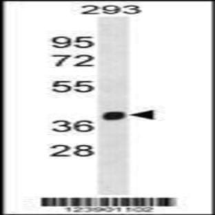 anti-Fanconi Anemia, Complementation Group L (FANCL) (C-Term), (AA 274-302) antibody avatar