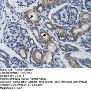 anti-Tripartite Motif Containing 68 (TRIM68) (Middle Region) antibody avatar