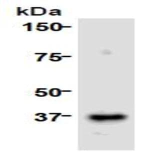 anti-Cell Division Cycle Associated 8 (CDCA8) (AA 1-280), (N-Term) antibody avatar