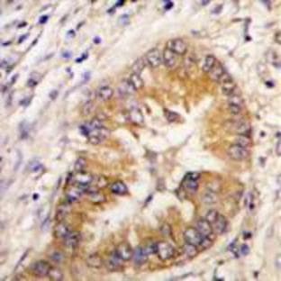 anti-Cell Division Cycle Associated 8 (CDCA8) (Center) antibody avatar