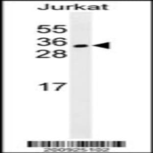 anti-Cell Division Cycle Associated 8 (CDCA8) antibody avatar