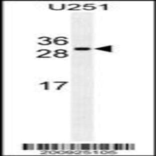 anti-Cell Division Cycle Associated 8 (CDCA8) antibody avatar