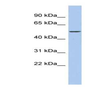 anti-DALR Anticodon Binding Domain Containing 3 (DALRD3) (Middle Region) antibody avatar