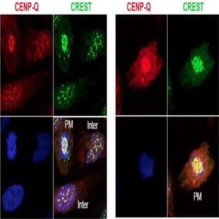anti-Centromere Protein Q (CENPQ) antibody avatar