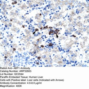 anti-Activator of Basal Transcription 1 (Abt1) (Middle Region) antibody avatar