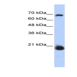 anti-Coiled-Coil-Helix-Coiled-Coil-Helix Domain Containing 4 (CHCHD4) (N-Term) antibody avatar
