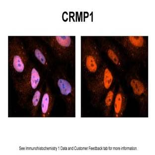 anti-Collapsin Response Mediator Protein 1 (CRMP1) (N-Term) antibody avatar