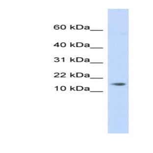 anti-Chromosome 11 Open Reading Frame 67 (C11ORF67) (Middle Region) antibody avatar