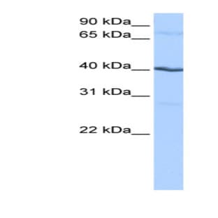 anti-Casein Kinase 1, gamma 2 (CSNK1G2) (N-Term) antibody avatar