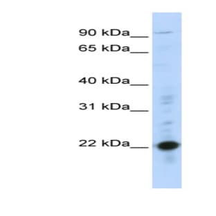 anti-Cysteine-Rich Protein 2 (CRIP2) (Middle Region) antibody avatar