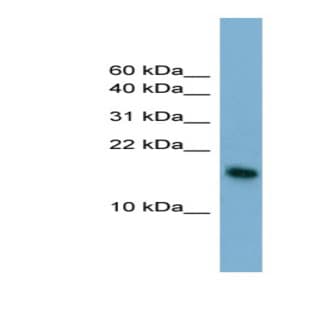 anti-Basic Leucine Zipper Transcriptional Factor ATF-Like 3 (BATF3) (N-Term) antibody avatar