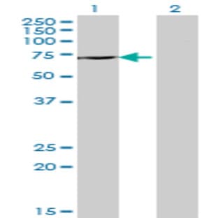 anti-DEAD (Asp-Glu-Ala-Asp) Box Polypeptide 43 (DDX43) (AA 2-91) antibody avatar