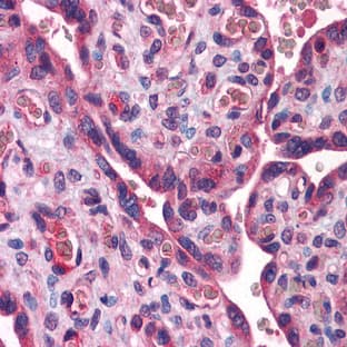 anti-Acyl-CoA Synthetase Long-Chain Family Member 1 (Acsl1) (C-Term) antibody avatar