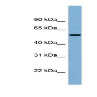 anti-Chromosome 2 Open Reading Frame 29 (C2orf29) (Middle Region) antibody avatar