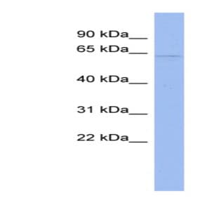 anti-CDKN2A Interacting Protein (CDKN2AIP) (N-Term) antibody avatar