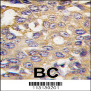 anti-Autophagy/beclin-1 Regulator 1 (AMBRA1) (N-Term), (AA 27-55) antibody avatar