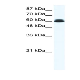 anti-DEAD (Asp-Glu-Ala-Asp) Box Polypeptide 27 (DDX27) (N-Term) antibody avatar