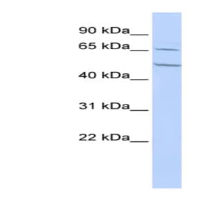 anti-Cholinergic Receptor, Nicotinic, alpha 4 (CHRNA4) (N-Term) antibody avatar