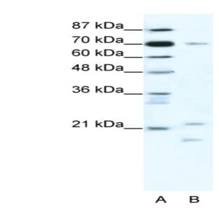 anti-Basic Transcription Factor 3 (BTF3) (Middle Region) antibody avatar