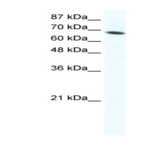 anti-DEAD (Asp-Glu-Ala-Asp) Box Polypeptide 1 (DDX1) (C-Term) antibody avatar