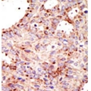 anti-ADP-Ribosylation Factor GTPase Activating Protein 1 (ARFGAP1) (C-Term) antibody avatar