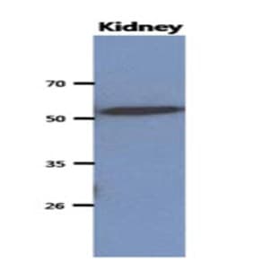 anti-CNDP Dipeptidase 2 (Metallopeptidase M20 Family) (CNDP2) (AA 1-475), (N-Term) antibody avatar